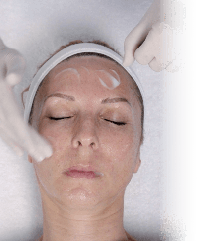 Peeling Eneomey application neutralizer 